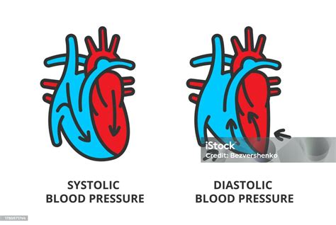Ilustración de la presión arterial sistólica y diastólica