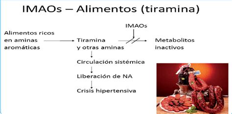 Infografía sobre alimentos ricos en tiramina