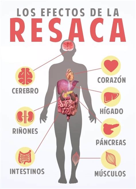 Gráfico mostrando los síntomas de la resaca y sus causas principales