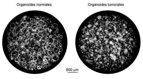 Ejemplo de organoide intestinal cultivado en laboratorio