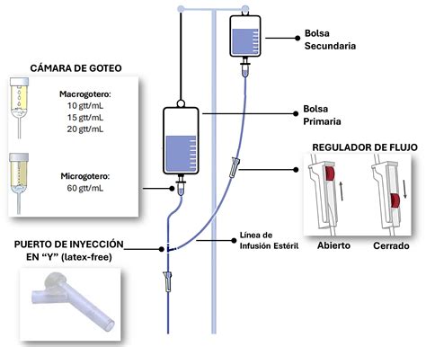 Proceso de infusión y retención de partículas