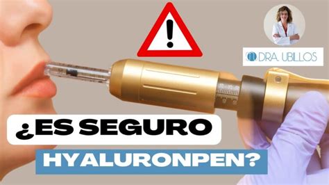 Infografía sobre el funcionamiento del Hyaluron Pen