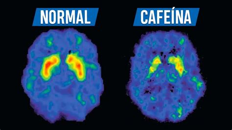 Ilustración de los efectos de la cafeína en el cerebro