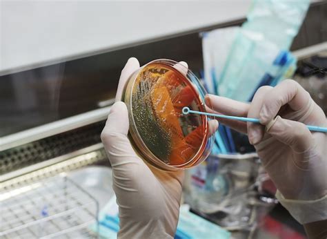 Proceso de cultivo bacteriano