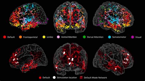 Gráfico de actividad cerebral
