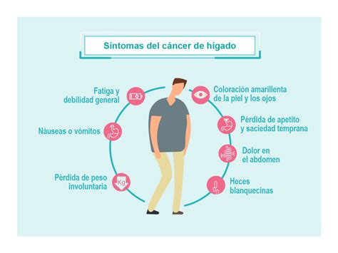 Infografía sobre los síntomas del cáncer de hígado