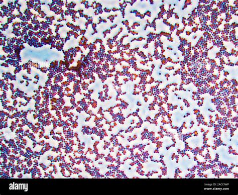 Micrografía de Staphylococcus aureus