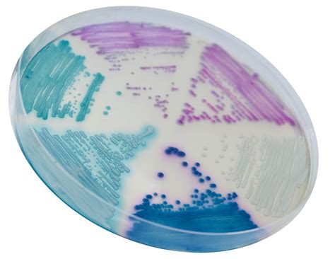 Placa de Petri con medio CHROMagar Candida PLUS y sus diferentes colores que pueden distinguir Candida auris de otras candida.