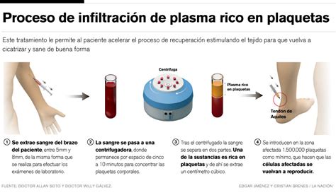Proceso de obtención e infiltración de Plasma Rico en Plaquetas (PRP)