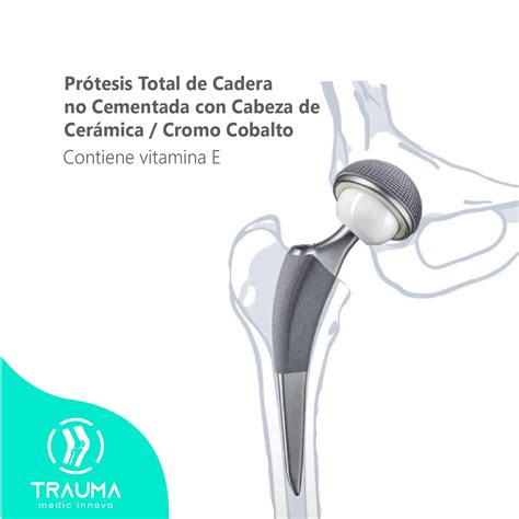 Ilustración de una prótesis total de cadera