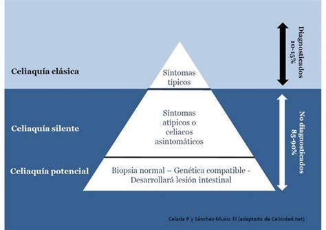Representación del 