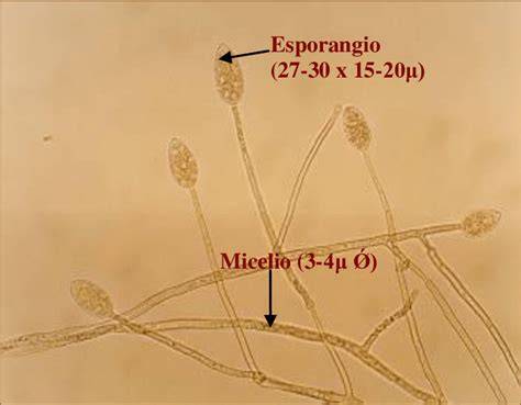 Esporangios de Phytophthora infestans vistos al microscopio