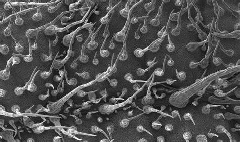 Microscopio electrónico de barrido de tricomas glandulares en una hoja de tomate