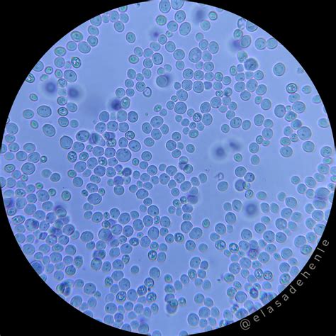 Células de levadura bajo microscopio