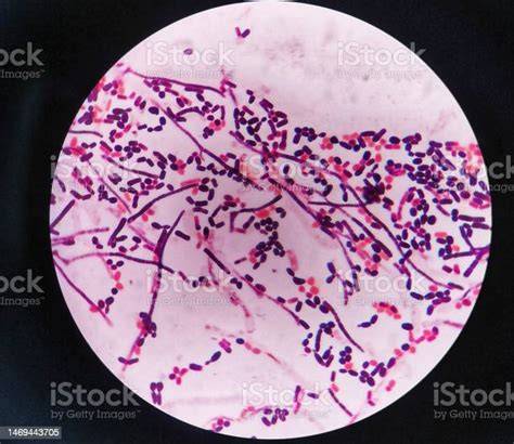Microscopio mostrando células de levadura