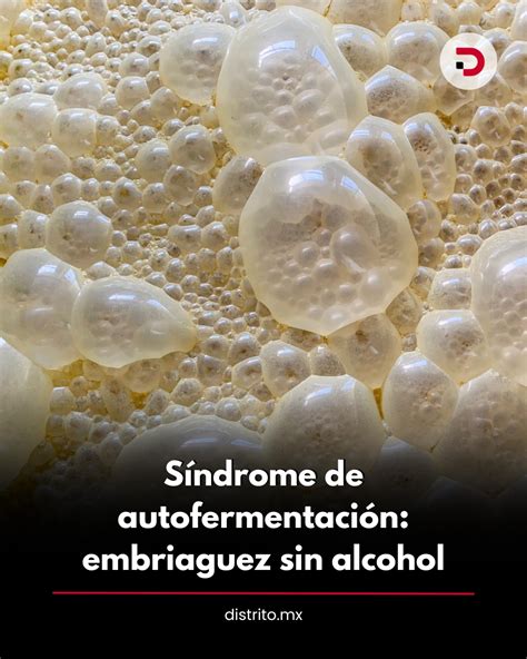 Ilustración de cómo el intestino produce alcohol a partir de carbohidratos
