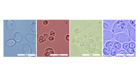 Microscopía de levaduras rojas y estructuras de monacolinas