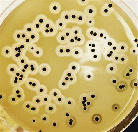 Colonias de Staphylococcus aureus en agar Baird-Parker