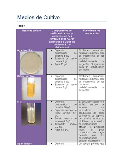 Tabla comparativa de medios de cultivo selectivos