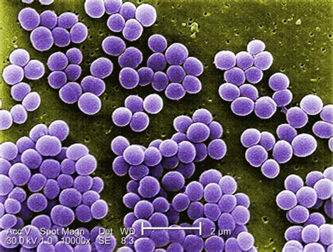Microfotografía de Staphylococcus aureus