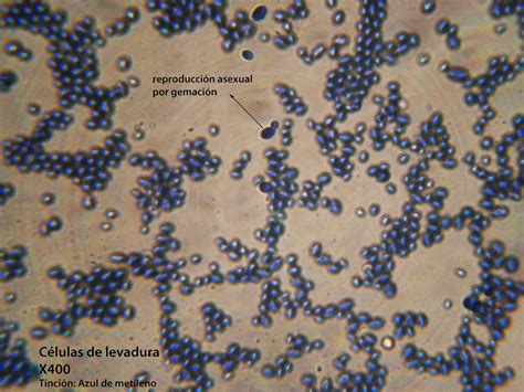 Microscopio con imagen de células de levadura de cerveza.