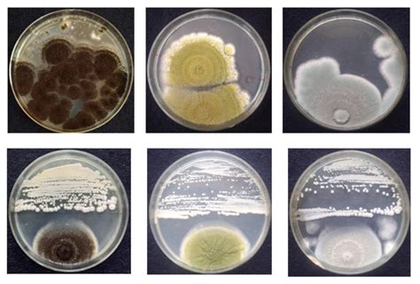 Diversas fuentes de muestras de levaduras