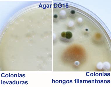 Diferencias entre colonias de levaduras y bacterias en placa de agar