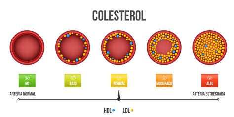 Gráfico comparativo de niveles de colesterol y presión arterial