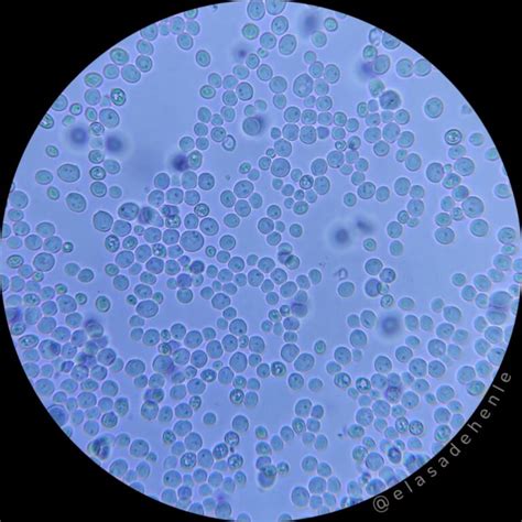 microscopio mostrando células de levadura