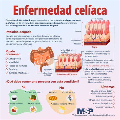 Infografía comparando alergia, intolerancia y enfermedad celíaca
