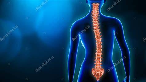 Representación de una columna vertebral con escoliosis