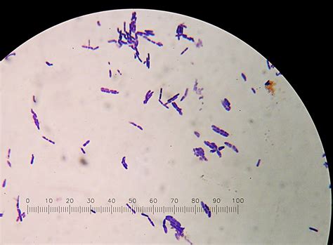 Bacillus cereus bajo microscopio