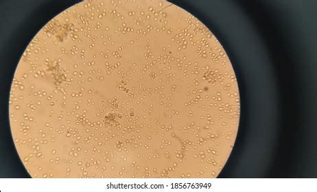 Cepa de levadura Saccharomyces cerevisiae bajo el microscopio