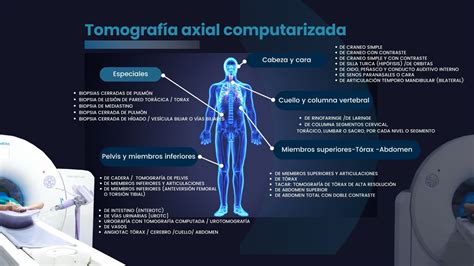 Imagen de tomografía computarizada mostrando una rotura traqueal