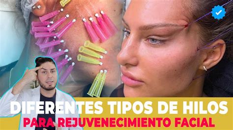 Infografía comparativa de los diferentes tipos de hilos tensores y sus aplicaciones