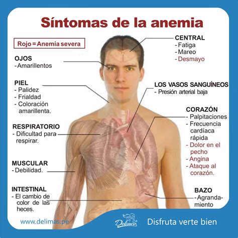 Síntomas de la anemia