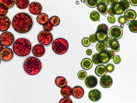 Imagen de microalgas Haematococcus pluvialis