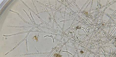 Estructura microscópica del micelio de hongos