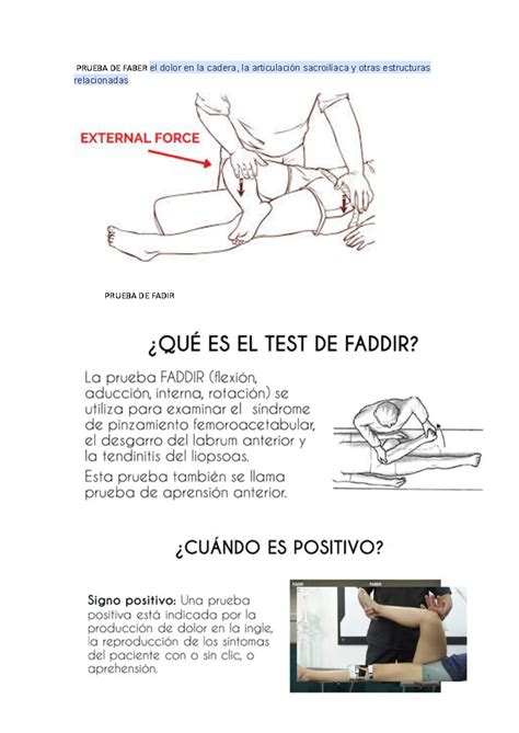 Representación de la maniobra de Faber para evaluar la articulación de la cadera