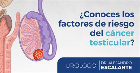 Factores de riesgo de cáncer testicular