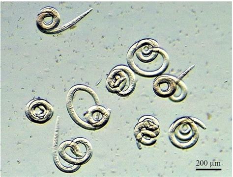 Larva de Trichinella spp. bajo el microscopio