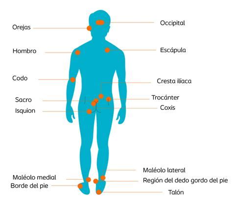 Esquema de las zonas del cuerpo afectadas por la candidiasis