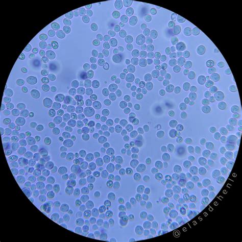 Microscopio de levaduras Saccharomyces cerevisiae