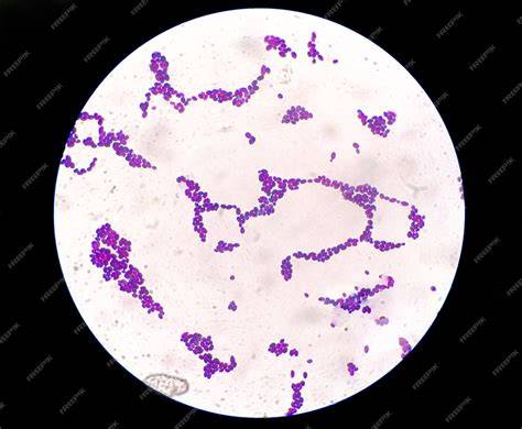 Ilustración de Candida albicans bajo microscopio