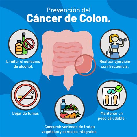 Infografía: Impacto del brócoli en la prevención del cáncer de colon