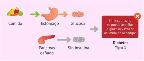 Diagrama que muestra la relación entre la enfermedad celíaca y la diabetes tipo 1.