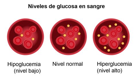 Gráfico comparativo del impacto en la glucosa en sangre de alimentos con y sin gluten.