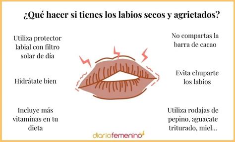 Labios agrietados y resecos