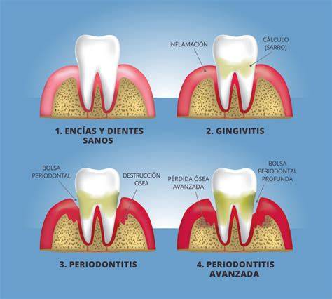 Problemas dentales y de encías
