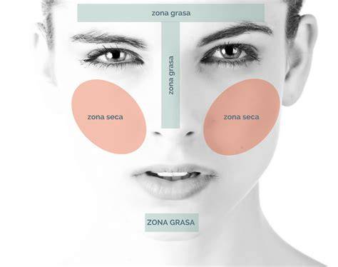 Zonas del rostro afectadas por la hiperpigmentación periocular